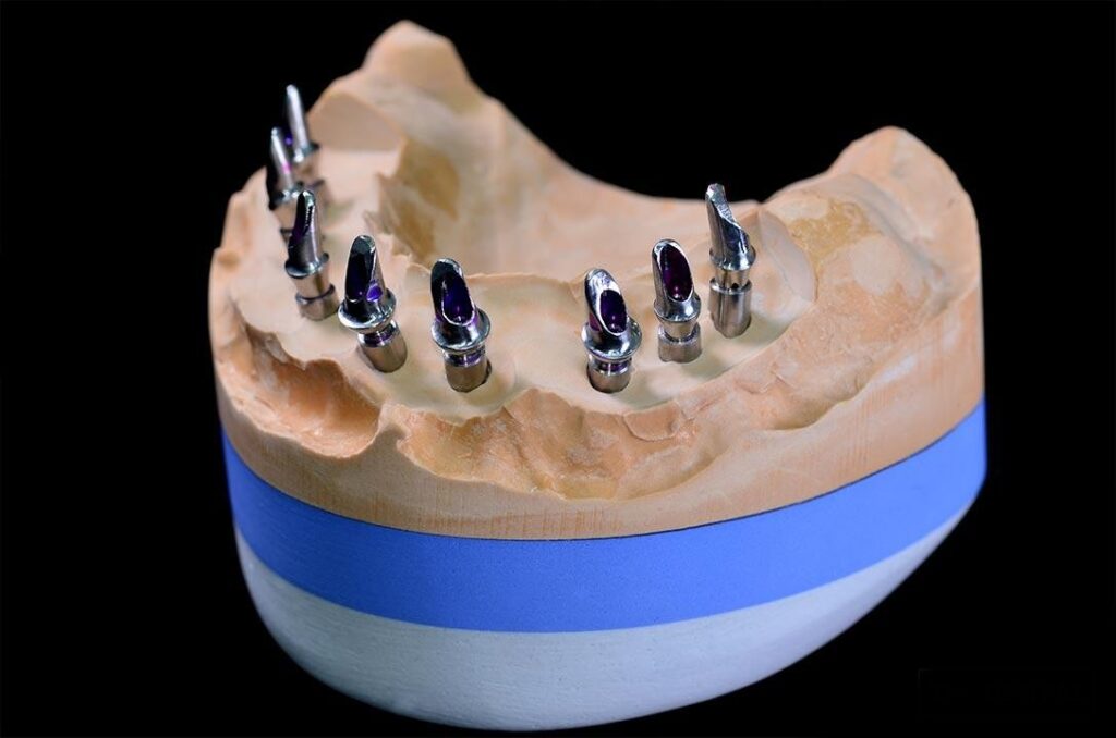 Εμφυτευματολογικές εργασίες