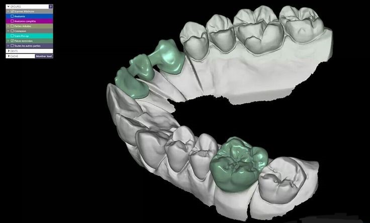 Σχεδιασμός & κατασκευή μέσω EXOCAD